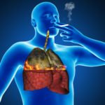 Pročistěte si své plíce od toxinů a nikotinu v průběhu 72 hodin